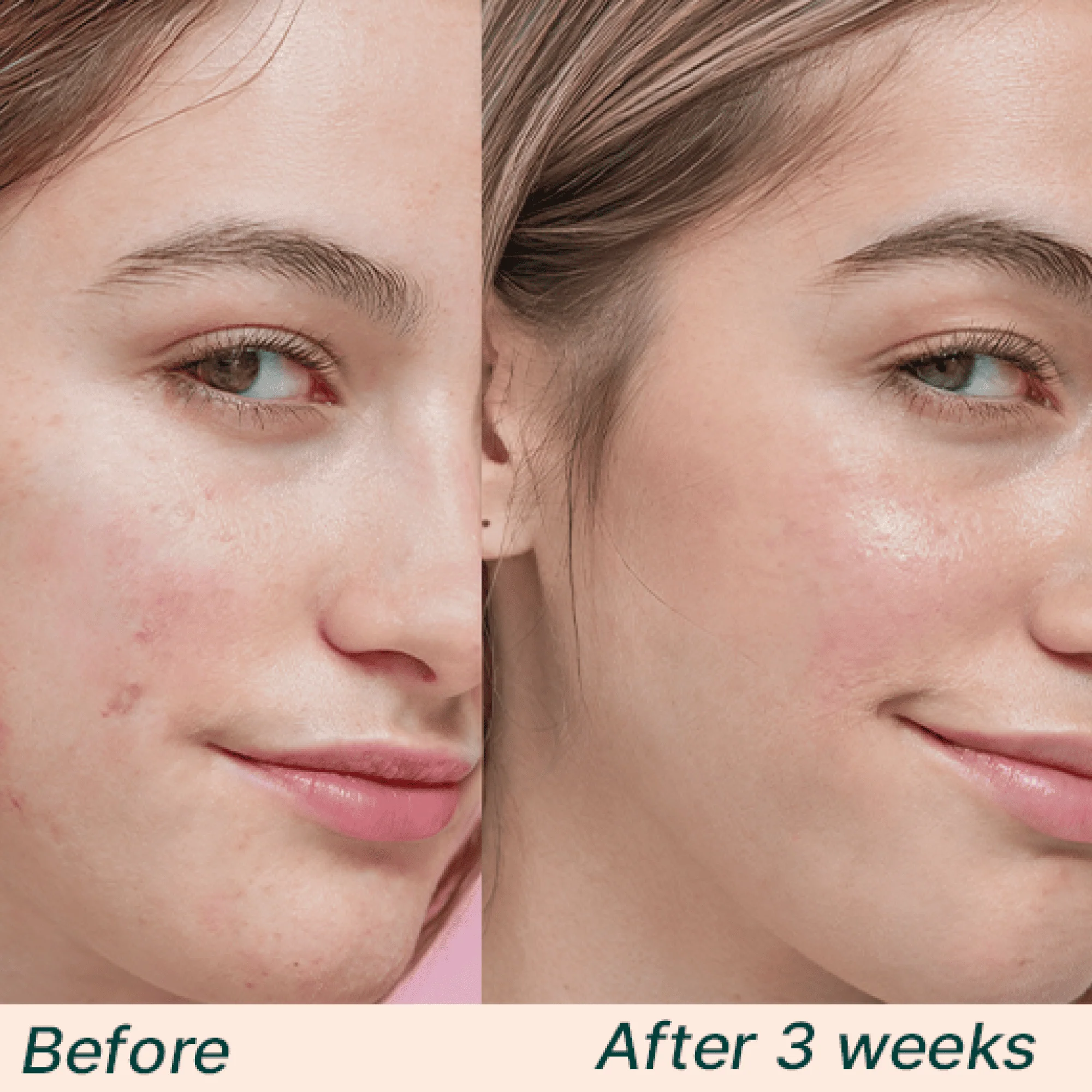 Hyaluronic Acid Trio Bundle - Image 2